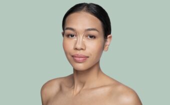 Näsplastik – en resa mot förnyat självförtroende