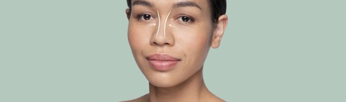 Näsplastik – en resa mot förnyat självförtroende